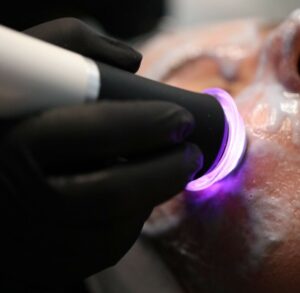 The End of “Fluff” Facials: Why Allegria Spa is Pivoting to a Results-Driven Model for Skin Health in Ohio